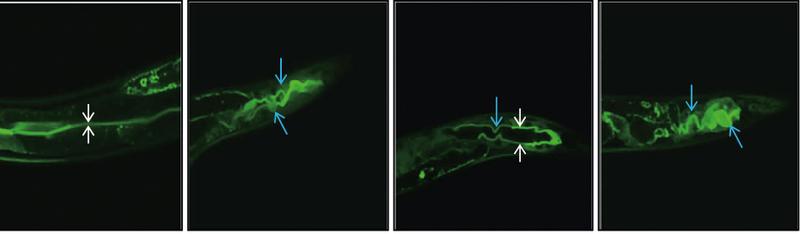 Fluorescence micrographs of the worm Caenorhabditis elegans infected with MakA toxin marked with green fluorescencent protein. The arrows show the twisted intestines