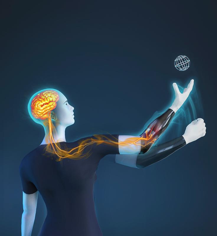 Die neuartige simultane Prothesensteuerung interpretiert die neuronalen Signale des Anwenders indirekt durch Auswertung schwacher elektrischer Potentiale der Stumpfmuskulatur