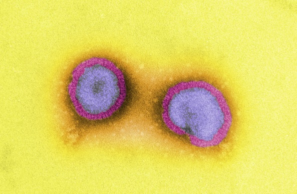 Influenza viruses
