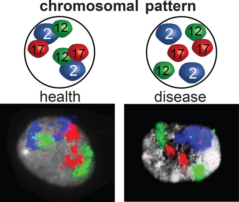 Researchers at the MDC and the University of Jena investigated the interactions between chromosomes 12 and 17.