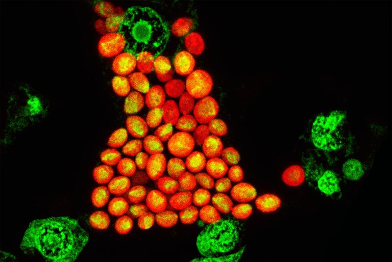 Mikroskopische Abbildung von Hydra-Epithelzellen (Zellkerne in grün), die jeweils etwa 20-30 symbiotische Chlorella-Algen enthalten (in orange).