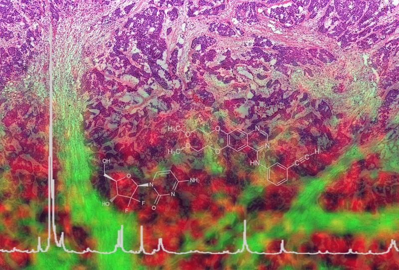 With the new technology a kind of molecular map can be created. 