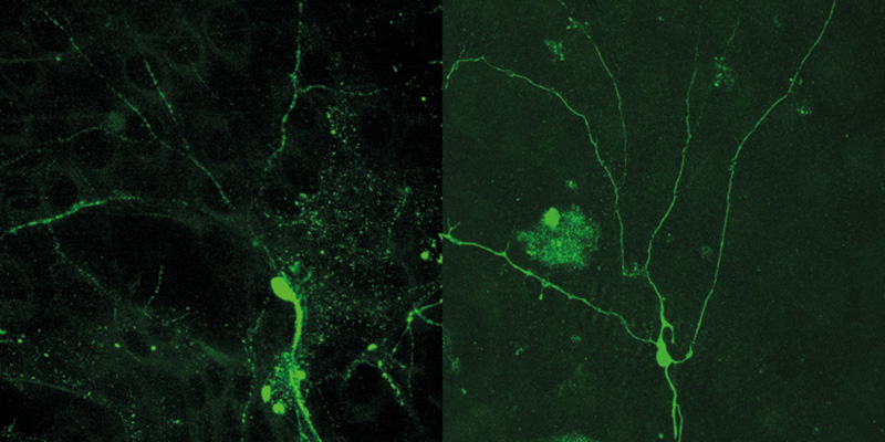 Li.: Mikrotubuli (grün) in den Dendriten von Nervenzellen zerfallen nah am Zellkörper (Punkt in der Mitte). Re.: Sind sie in ihrer polaren Ausrichtung verändert, bauen sie sich nicht mehr richtig ab.