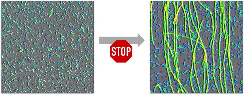 Oligomere (links) verhindern aktiv, dass sie zu Fibrillen (Fäden im rechten Bild) abgebaut werden.
