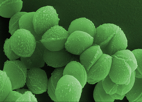 Streptococcus pyogenes ist der Hauptauslöser der nekrotisierenden Fasziitis.