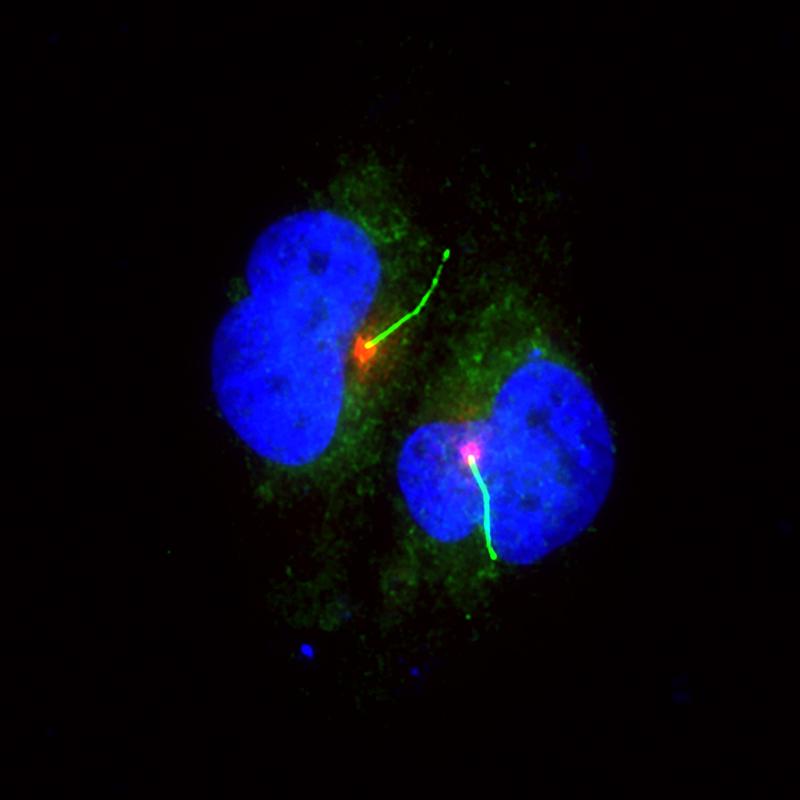 Pigment cells (blue/green) with cilium (light green with red base).