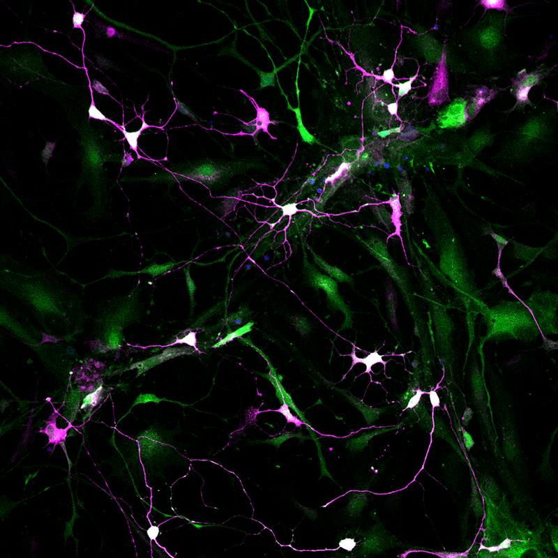 Most pericytes in which both factors, Ascl1 and Sox2, are expressed (green) transform into morphologically-complex neuron