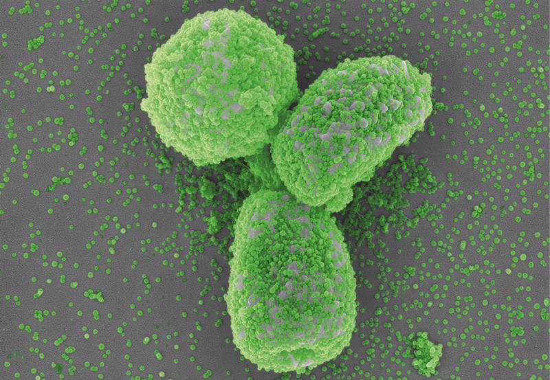 Elektronenmikroskopische Aufnahme von mit Nanopartikeln (grün) bedeckte Aspergillus fumigatus Pilzsporen.  