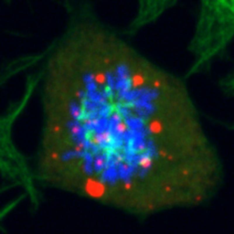 In dieser Zelle wurde das Enzym DYRK3 gehemmt, was zu Defekten in der Zellteilung führte (rot: Tröpfchen, grün: Spindel, blau: DNA).