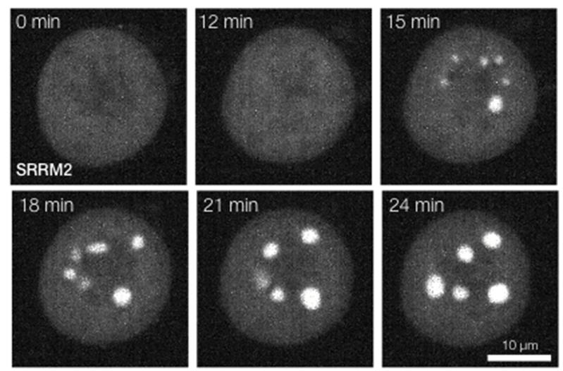 Diese Bilderserie aus einem Film zeigt die Phasentrennung eines Proteins nach Hemmung des Enzyms DYRK3 (Zeit in Min. nach Hemmstoff-Zugabe).
