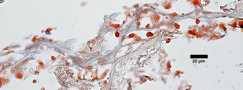 Fat tissue in the Iceman's stomach