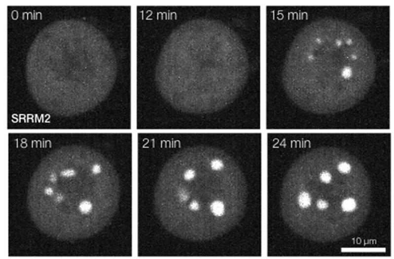 In this series of frames from a movie, phase separation of a protein is observed upon inhibiting the enzyme DYRK3 (time in min. after adding the inhibitor).