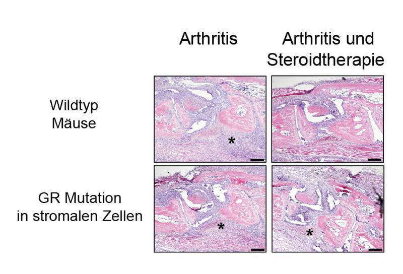 Histologische Untersuchungen von arthritischen Wildtyp-Mäusen und Mäusen mit einer Mutation des Kortison-Rezeptors (vollständige BU unter der Pressemitteilung)