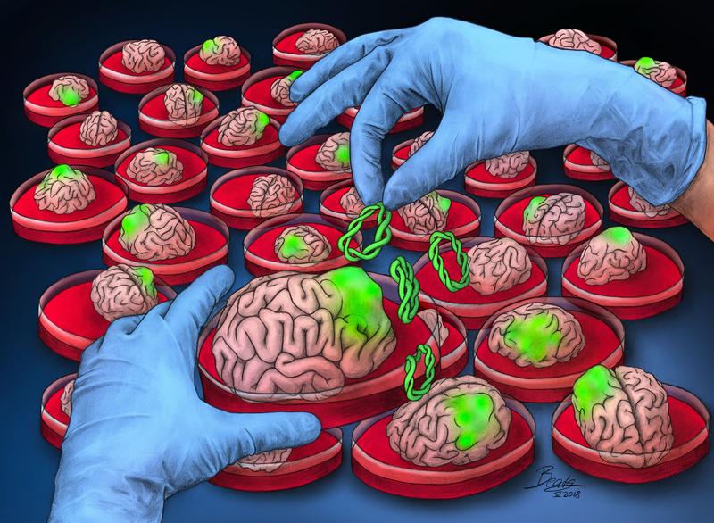 Artistic interpretation of the neoplastic novel brain-cancer or neoplastic organoids which offer a means to investigate, how some of these mutations are driving forces in tumors.