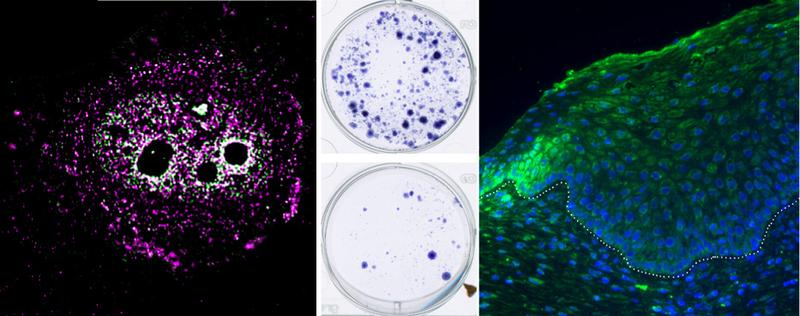 MYPOP-Lokalisation (magenta) in einer Hautzelle; Wachstum von HPV-Krebszellen ohne (oben) und mit MYPOP (unten); Gewebeschnitt eines HPV-Tumors (grün = MYPOP, blau = Zellkerne);