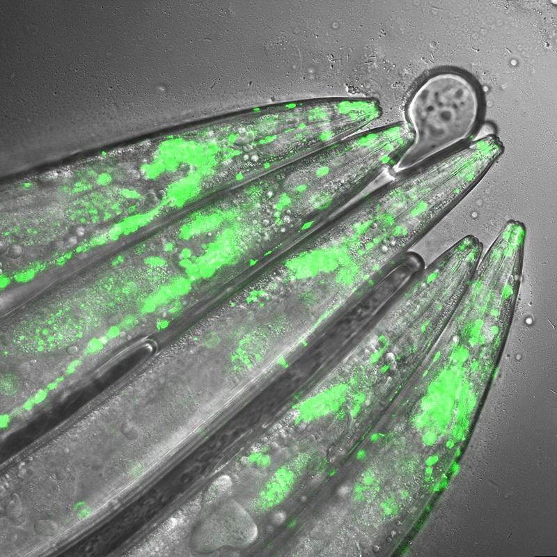 The image shows a C.elegans model of Huntington’s disease under the microscope. When the scientists silence the protein UBR5, they see a dramatic increase in the number of toxic protein aggregates in 