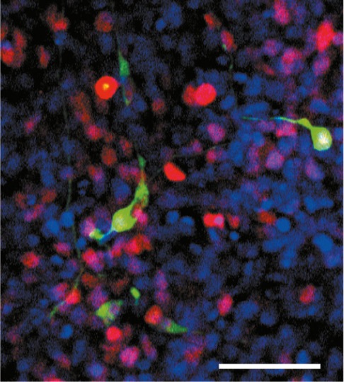 LCSB-Forscher prognostizieren Faktoren zur Zellumwandlung – Potential für regenerative Medizin