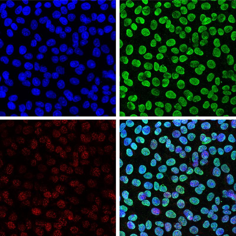 Resistente Zellen mit wiederhergestellter DNA-Reparatur. Blau: DNA in Zellkernen, Grün: PAR-Ketten (Plattform für DNA-Reparaturproteine), Rot: rekrutierte DNA-Reparaturproteine, und Mix aller 3 Farben