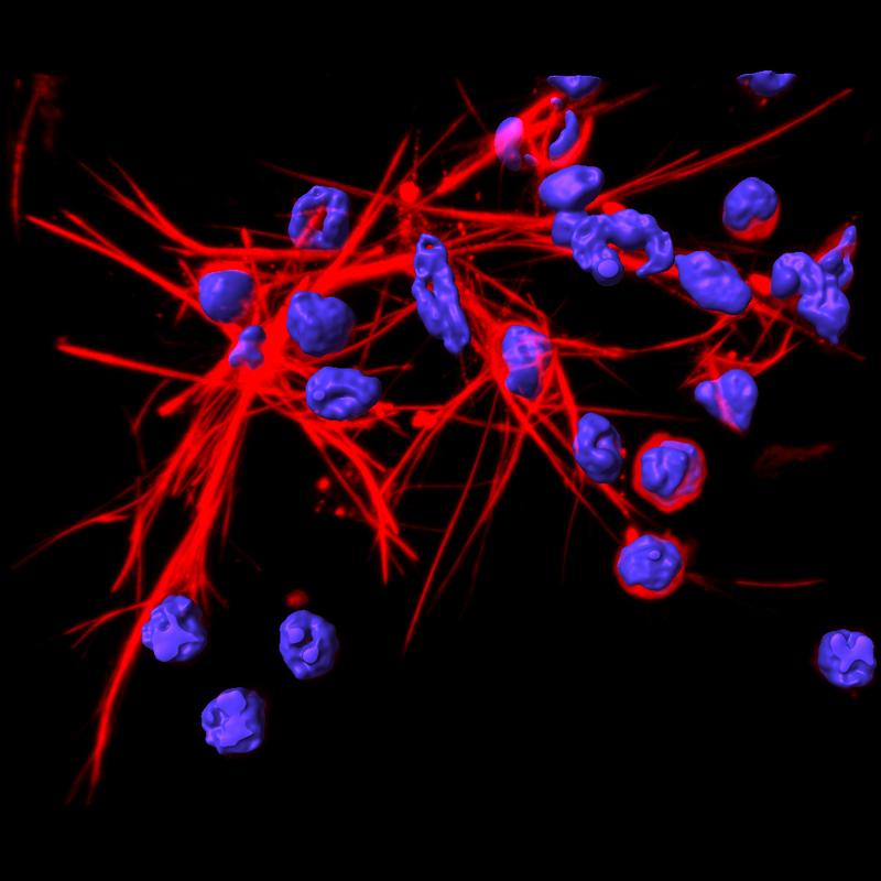 DNA-Netze (rot), die von Neutrophilen aufgestellt werden. 