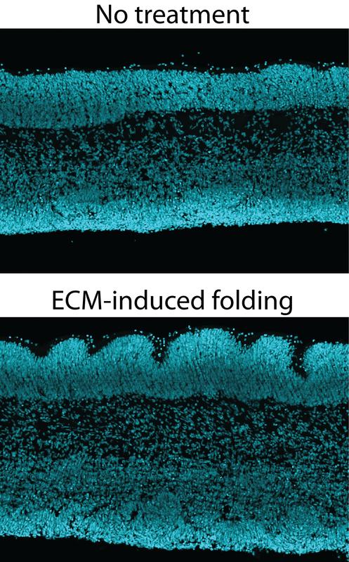 Human fetal neocortex tissue in culture without any treatment, with a smooth cortical plate (top image), and after ECM-induced folding, with a folded cortical plate (bottom image).