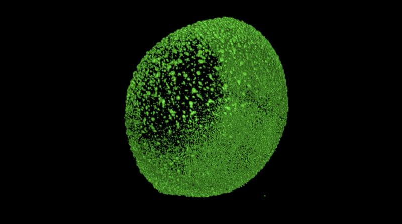 Zebrafish development imaged by light sheet microscopy. The picture shows the fluorescent nuclei (histones labeled with green fluorescent protein) of all cells.