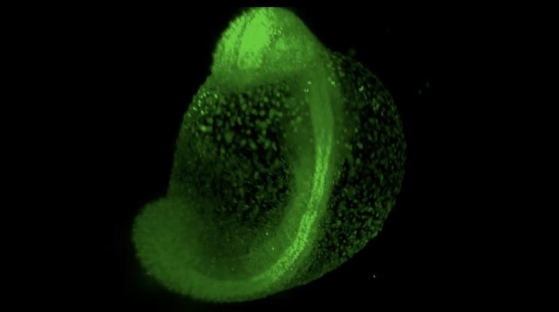 Zebrafish development imaged by light sheet microscopy. The picture shows the fluorescent nuclei (histones labeled with green fluorescent protein) and the formation of first organ precursors.