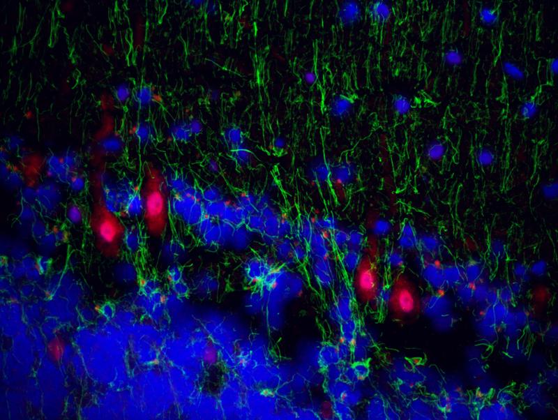 Immunfluoreszenzaufnahme aus der Kleinhirnrindenregion von bipolaren Patienten, die Proteine von humanen Herpesviren (rot) in Purkinje-Neuronen zeigen. Astrozyten sind grün gefärbt.