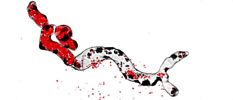 Hyphen des humanpathogenen Schimmelpilzes Aspergillus fumigatus nach Azol-Exposition. Die Mitochondrien des Pilzes sind rot und die Zellwände und Zellwand-Patches schwarz eingefärbt. 