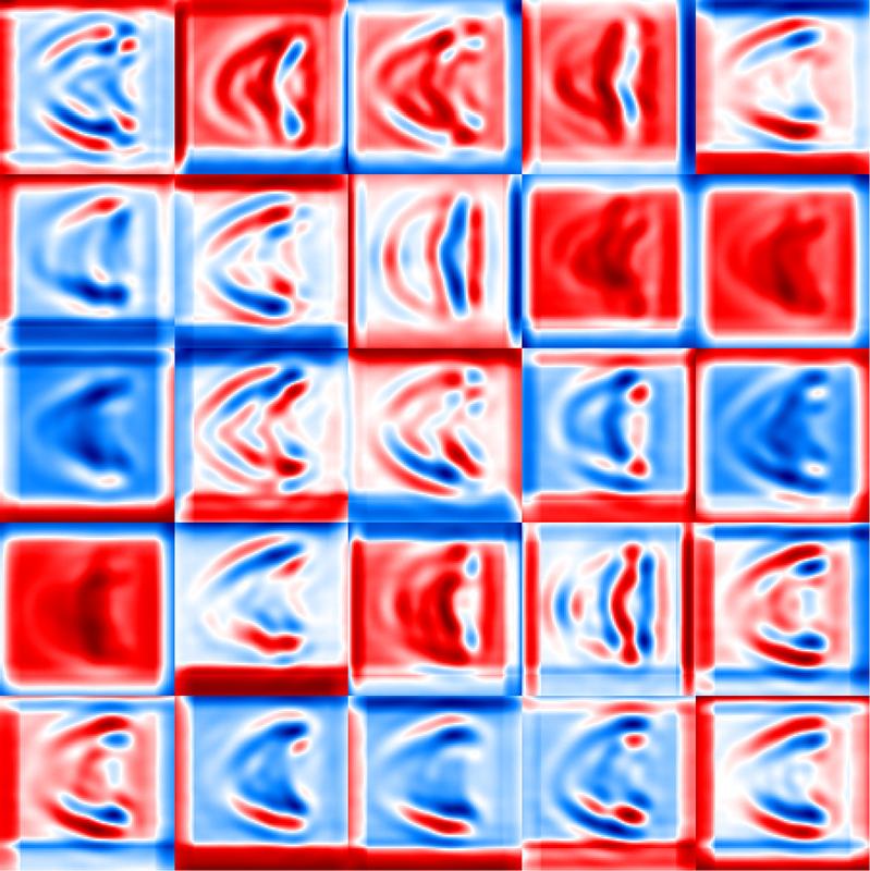 Die Analyse-Software erfasst über Mustererkennung schnell große Mengen von Zellen und klassifiziert diese anhand von charakteristischen Krümmungen und Wölbungen: Hier die symmetrische Croissant-Form.