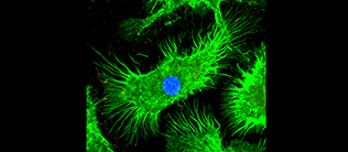 Aktivierte Makrophagen in der Immunfluoreszenz-Mikroskopie, die thrombo-inflammatorische Mikropartikel generieren (grün: Cytoskelett der Zelle (F-Actin), blau: Zellkern, rot: Tissue Factor)