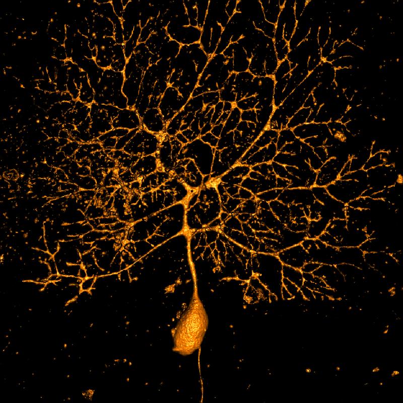 Eine Purkinjezelle: Das Neuron erinnert vor einer Bewegung an vergangene Bewegungsfehler.
