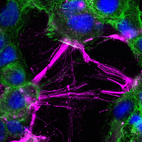 Mikroskop-Bild von Zellen, die mechanischen Scherkräften ausgesetzt wurden. Die Zellen (blau: Zellkern, grün: Aktin-Zellskelett) verändern ihre Form, ziehen sich zusammen und lösen ihre Kontakte