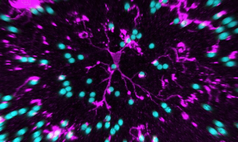 Die Mikroglia (pink) dient dem Gehirn auch als eine Art Müllabfuhr: Kleine, mit Proteinen ummantelte Latexkügelchen (türkis) werden von den Immunzellen des Gehirns rasch aufgenommen und verdaut.