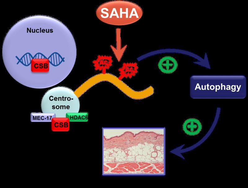 The HDAC inhibitor SAHA rescues the skin phenotype of CSB-deficient mice