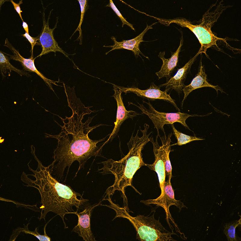 Hypothalamische Neuronen in Zellkultur, die teilweise auf Leptin reagieren (rot). Die Zellkerne sind in Blau, die Membran in Gelb angefärbt.  