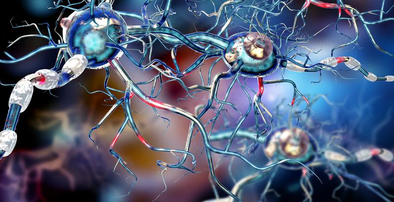 Bei der Multiplen Sklerose greift das Immunsystem die Myelinhülle der Nervenfasern an (weiss).