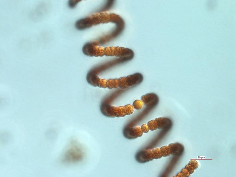 Mikroskopaufnahme der stickstofffixierenden Blaualge Anabaena crassa aus dem Müggelsee. 