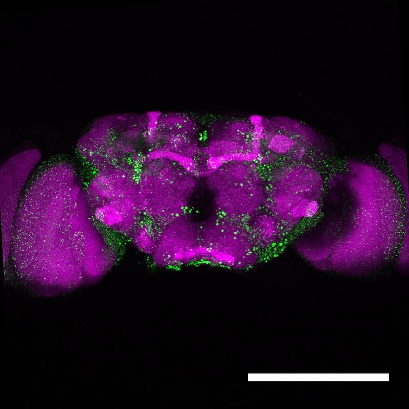 Mikroskopische Aufnahme eines Fliegengehirns. In Grün sind die Huntingtin-Ablagerungen erkennbar, die durch das mutierte Huntingtin-Protein entstehen.