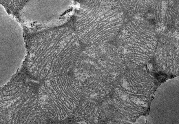 Die lange, nicht-kodierende RNA H19 beeinflusst die Ausbildung und Funktion brauner Fettzellen. Bild: braunes Fettgewebe. 