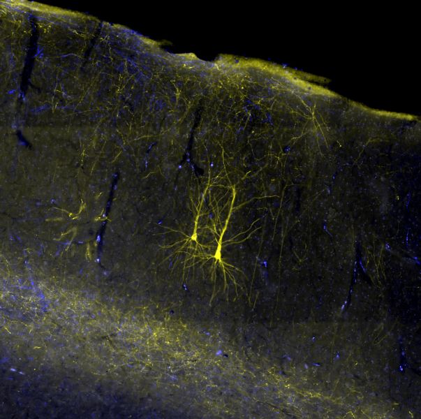Two nerve cells in the brain of a rhesus monkey visualized with a yellow fluorescent dye.