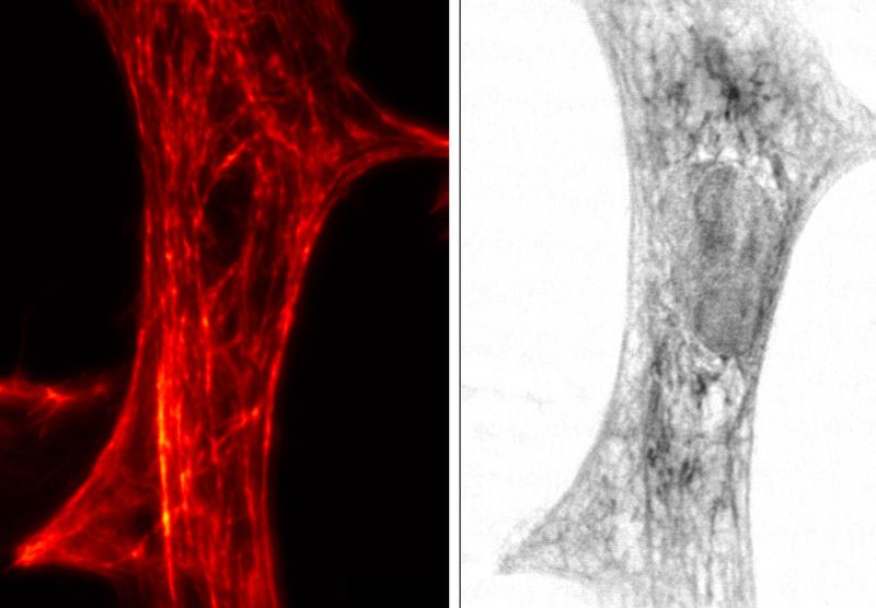 STED image (left) and x-ray imaging (right) of the same cardiac tissue cell from a rat.