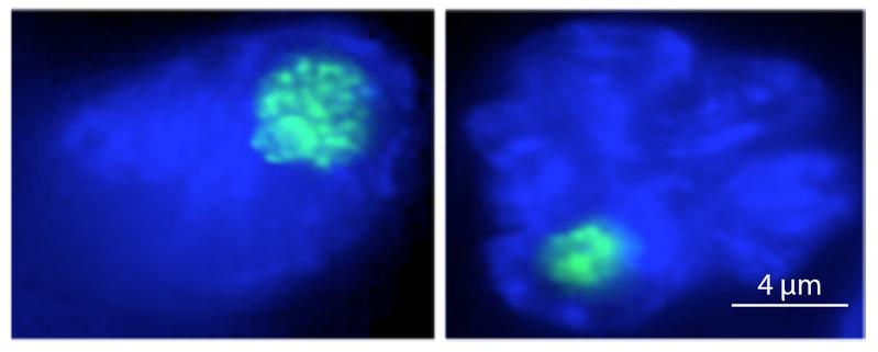 Der Nukleolus (in grün) von Makrophagenzellen schrumpft bei einer bakteriellen Infektion (links: nicht infizierter Makrophage, rechts: bakteriell infizierter Makrophage). 