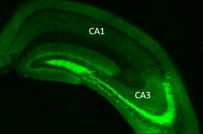 Wie werden Raum und Zeit im Gehirn kodiert? Für das episodische Gedächtnis sind vor allem die Unterregionen CA1 und CA3 mit ihren Neuronen-Ensembles im Hippocampus entscheidend. 