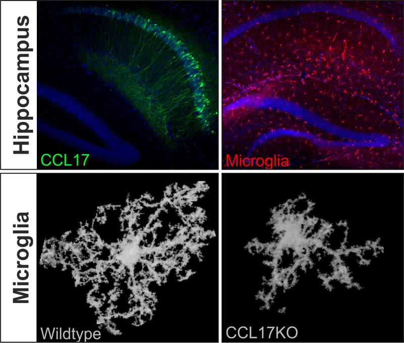 Oben: CCL17-produzierende Neurone (grün) und Microglia (rot) im Hippocampus. Unten: Rekonstruktion der Struktur einer einzelnen Mikrogliazelle im Wildtyp beziehungsweise CCL17-knockout. 