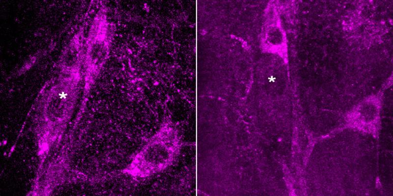 When the nervous system of fruit flies develops, the gene MICAL is important. Left: The gene is produced in nerve cells (asterisk). Right: If the protein eIF3 is inhibited, MICAL is absent (asterisk)