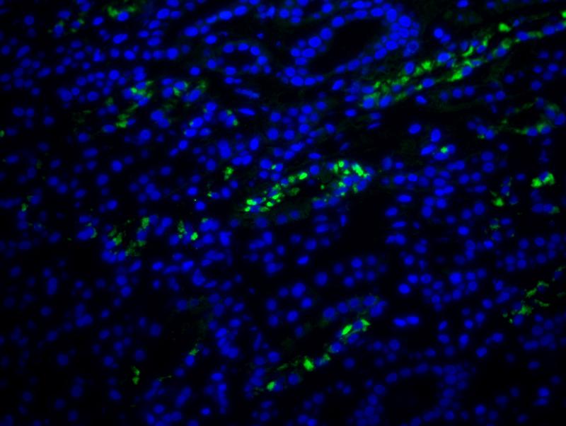   Fluoreszenzaufnahme aus der Nierenbiopsie der DRESS-Patientin mit HHV-6-kodierter sncRNA-U14 (grün). Die DNA wurde blau gefärbt. 