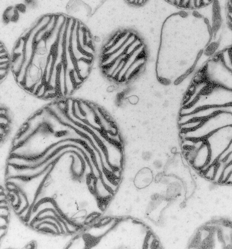 The microscope image shows mitochondria, the cell's power plants.