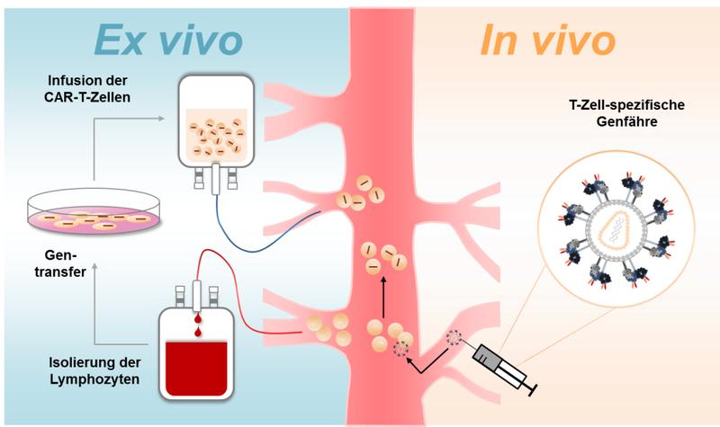 Schematic representation of CAR T cell generation. On the left, ex vivo CAR T cell generation, on the right, vector particle, which selectively introduces genetic information for the CAR into T cells