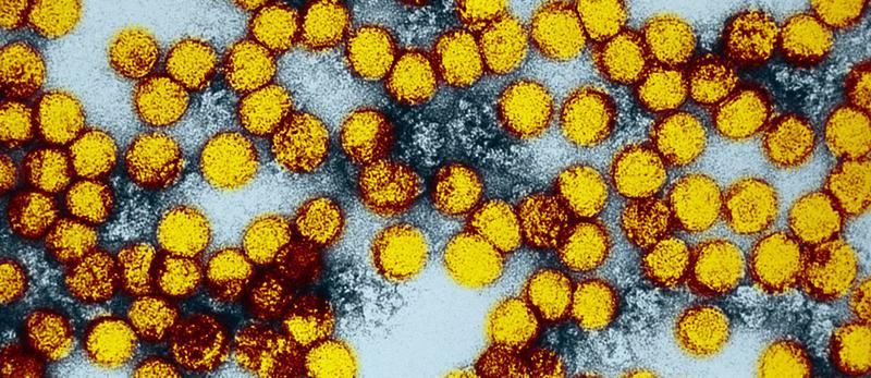Gelbfieber-Viren unterm Elektronenmikroskop. Forscher des Max-Planck-Instituts für Dynamik komplexer technischer Systeme vermehren die Erreger in Bioreaktoren. Diese Technik könnte bald auch in d