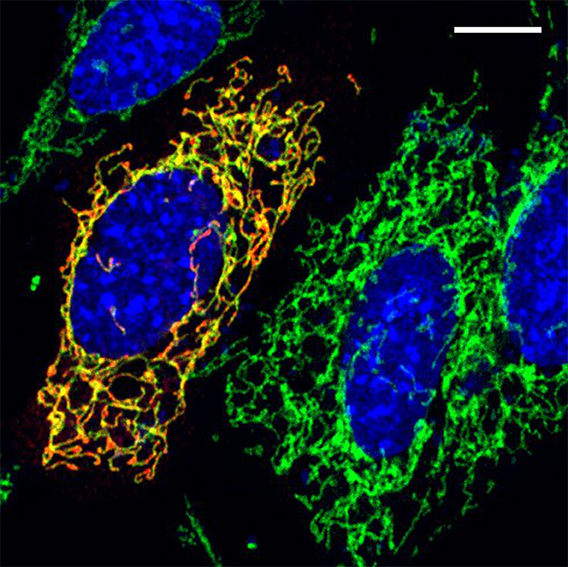 Eine virusinfizierte Zelle in einer Zellkultur, die von nicht infizierten Zellen umgeben ist. Mitochondrien in grün. Der orange-rot markierte Virus (links) befindet sich in den Mitochondrien